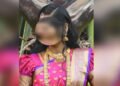 ಸಿಸೇರಿಯನ್ ಮಾಡುವ ವೇಳೆ ಹೊಟ್ಟೆಯಲ್ಲಿ ಬಟ್ಟೆ ಉಂಡೆ
