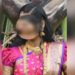 ಸಿಸೇರಿಯನ್ ಮಾಡುವ ವೇಳೆ ಹೊಟ್ಟೆಯಲ್ಲಿ ಬಟ್ಟೆ ಉಂಡೆ