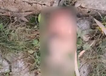 ಆಸ್ಪತ್ರೆಯ ಹೊರಗೆಯೇ ನವಜಾತ ಶಿಶುವಿನ ತಲೆಯನ್ನು ಕಚ್ಚಿ ತಿಂದ ನಾಯಿಗಳು!