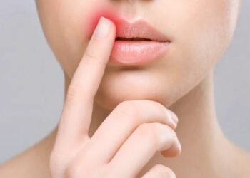 ಭಾರತದಲ್ಲಿ ಶೇ.50 ಕ್ಕೂ ಹೆಚ್ಚು ಜನರಲ್ಲಿ ಸರ್ಪಸುತ್ತಿನ ಬಗ್ಗೆ ಮಾಹಿತಿ ಇಲ್ಲ!