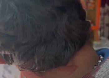 ಲೋನ್ ರಿಕವರಿಗೆಂದು ಬಂದ ಸಿಬ್ಬಂದಿ ಮೇಲೆ ಕಲ್ಲಿನಿಂದ ಹಲ್ಲೆ