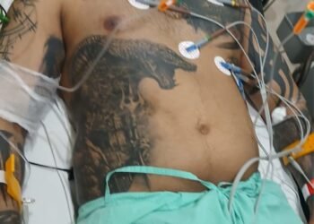 ರಿಕ್ಕಿ ರೈ ಮೇಲೆ ಕಾದು ಕುಳಿತು ನಡೆಯಿತಾ ಅಟ್ಯಾಕ್?