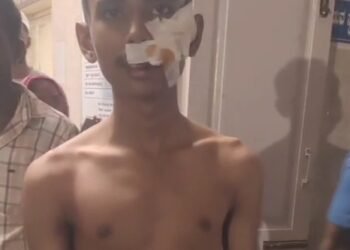 ಬಾಲಕನ ಮೇಲೆ ಬೀದಿ ನಾಯಿಗಳು ಅಟ್ಯಾಕ್