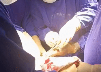 ಮೂಳೆ ಆಪರೇಷನ್‌ ಮಾಡಿದ ಶಾಸಕ