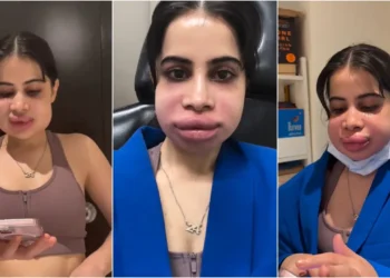 ನಟಿ ಉರ್ಫಿ ಜಾವೇದ್ ಮುಖಕ್ಕೆ ಏನಾಯಿತು?