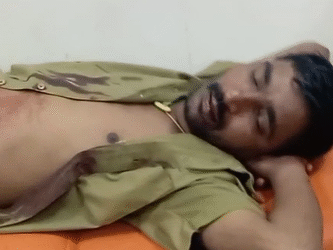 ಹಳೆ ದ್ವೇಷ: ಆಟೋ ಚಾಲಕನಿಗೆ ಚಾಕು ಇರಿತ