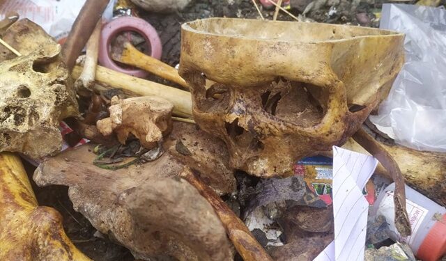 ಬೆಂಗಳೂರು | ಕಸದ ತೊಟ್ಟಿಯ ಬಳಿ ಮಾನವ ಬುರುಡೆ ಪತ್ತೆ !