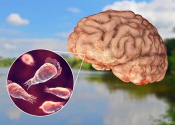 ಕೇರಳದಲ್ಲಿ ಮೆದುಳು ತಿನ್ನುವ ಅಮೀಬಾಗೆ ಈವರೆಗೆ 19 ಬಲಿ: ಏನಿದು ಮಾರಣಾಂತಿಕ ಸೋಂಕು? ಇದು ಹೇಗೆ ಹರಡುತ್ತದೆ?