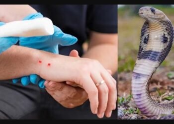 ಹಾವು ಕಡಿತ ಪ್ರಕರಣ | ಒಂದೇ ವರ್ಷದಲ್ಲಿ 13,494 ಪ್ರಕರಣ, 79 ಮಂದಿ ಸಾವು