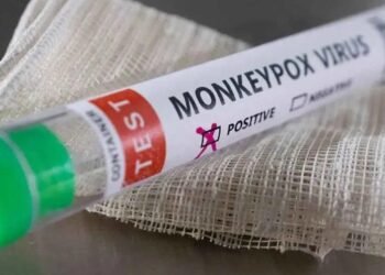 ಹೊಸನಗರ | ಜ್ವರ ಎಂದು ಆಸ್ಪತ್ರೆಗೆ ಹೋದ ಮಹಿಳೆಗೆ ‘ಮಂಗನ ಕಾಯಿಲೆ’ ಪಾಸಿಟಿವ್ ; ಜನರಲ್ಲಿ ಆತಂಕ!