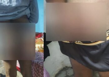 ವಿಚಾರಣೆ ನೆಪದಲ್ಲಿ ಕ್ಯಾನ್ಸರ್​​ ರೋಗಿ ಮೇಲೆ  ಮಾರಣಾಂತಿಕ ಹಲ್ಲೆ | ಕೆಂಭಾವಿ PSI ವಿರುದ್ಧ ಗಂಭೀರ ಆರೋಪ