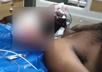 ಕ್ಷುಲ್ಲಕ ಕಾರಣಕ್ಕೆ ಜಗಳ | ಕಬ್ಬು ಕತ್ತರಿಸುವ ಮಚ್ಚಿನಿಂದ ಯುವಕನ ಮೇಲೆ ಮಾರಣಾಂತಿಕ ಹಲ್ಲೆ