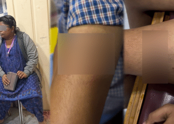 ಹೋಂವರ್ಕ್ ಮಾಡಿಲ್ಲವೆಂದು ಬಾಲಕನಿಗೆ ಹಿಗ್ಗಾಮುಗ್ಗಾ ಥಳಿಸಿದ ಶಿಕ್ಷಕಿ | FIR ದಾಖಲು!