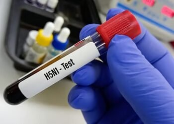 ಚೆನ್ನೈನಲ್ಲಿ ಹಕ್ಕಿ ಜ್ವರಕ್ಕೆ ನೂರಾರು ಕಾಗೆಗಳ ಸಾವು | ತಮಿಳುನಾಡು ಸರ್ಕಾರದಿಂದ ಹೈ ಅಲರ್ಟ್