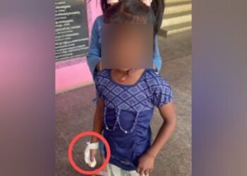 ಶಾಲೆಯ ಬಾಗಿಲಿಗೆ ಸಿಲುಕಿ ತುಂಡಾದ ವಿದ್ಯಾರ್ಥಿನಿಯ ಕೈ ಬೆರಳು | ಶಿಕ್ಷಕರ ವಿರುದ್ಧ ಪೋಷಕರ ಆಕ್ರೋಶ