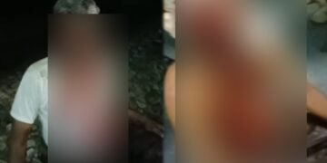 ಕೆಂಗೇರಿ ರೈಲ್ವೆ ನಿಲ್ದಾಣದಲ್ಲಿ ಆತ್ಮಹತ್ಯೆಗೆ ಯತ್ನಿಸಿದ ವ್ಯಕ್ತಿ | ಗಂಭೀರ ಗಾಯ