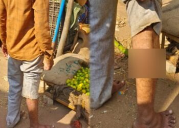 ಮಾಗಡಿ | ತರಕಾರಿ ವ್ಯಾಪಾರಿಯ ಮೇಲೆ ನಾಯಿ ದಾಳಿ