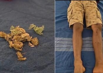 ಚೆಂಡು ಅಂತಾ ಬ್ಯಾಟ್ ನಿಂದ ಹೊಡೆದಾಗ ಸ್ಫೋ*ಟ!