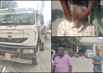 ವೃದ್ಧ ವ್ಯಕ್ತಿ ಮೇಲೆ ಹರಿದ ಲಾರಿ | ಸ್ಥಿತಿ ಗಂಭೀರ