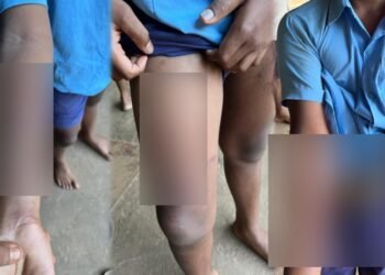 ರಾಕ್ಷಸರೋ.. ಶಿಕ್ಷಕರೋ.. ಪಾಠ ಕಲಿಸುವವರಿಂದಲೇ ನೀಚ ಕೃತ್ಯ : ಪೋಷಕರ ಆಕ್ರೋಶ!