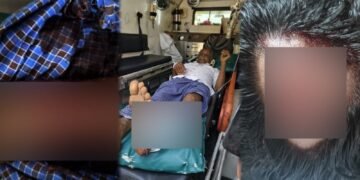 ಆಸ್ತಿ ವಿಚಾರಕ್ಕಾಗಿ ದಾಯಾದಿಗಳ ಮಧ್ಯೆ ಮಾರಾಮಾರಿ – ಮೂವರಿಗೆ ಗಂಭಿರ ಗಾಯ