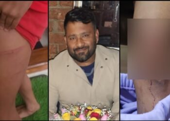 ಅಪ್ರಾಪ್ತ ಮಕ್ಕಳ ಮೇಲೆ ಕಾಂಗ್ರೆಸ್‌ ಮುಖಂಡನಿಂದ ಮಾರಣಾಂತಿಕ ಹಲ್ಲೆ – ಕೇಸ್‌ ದಾಖಲು!