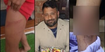 ಅಪ್ರಾಪ್ತ ಮಕ್ಕಳ ಮೇಲೆ ಕಾಂಗ್ರೆಸ್‌ ಮುಖಂಡನಿಂದ ಮಾರಣಾಂತಿಕ ಹಲ್ಲೆ – ಕೇಸ್‌ ದಾಖಲು!